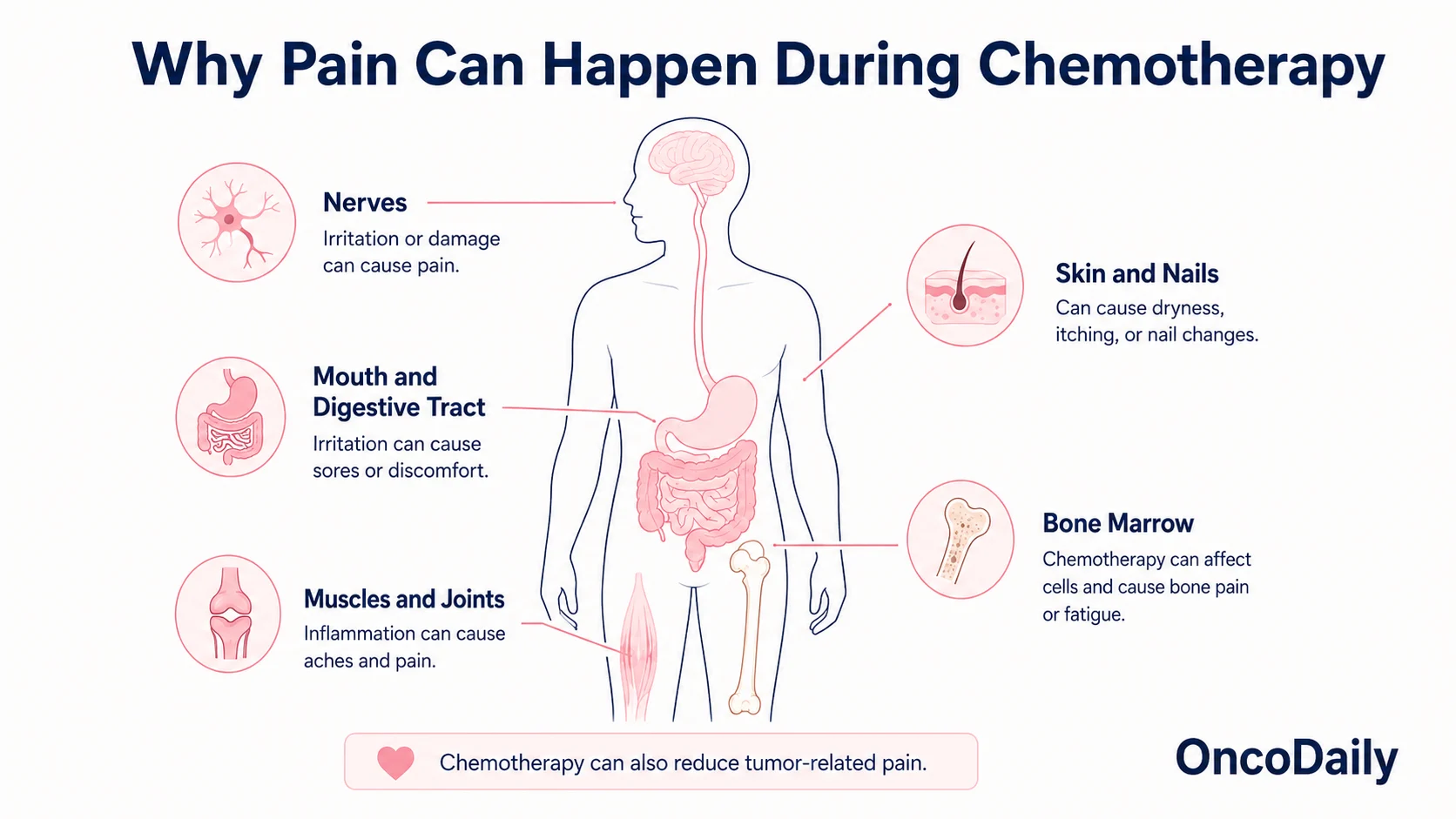 Can Chemotherapy Be Painful? 3 Chemotherapy Pain