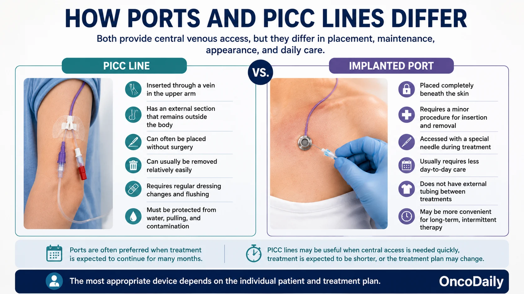 Ports