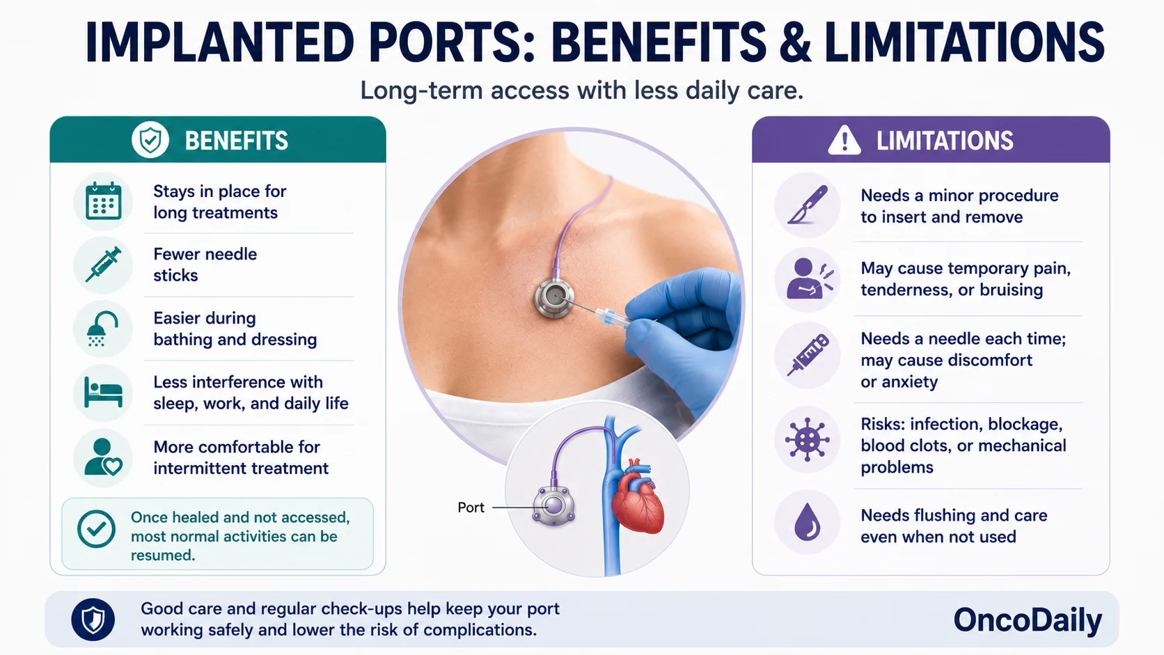 Ports