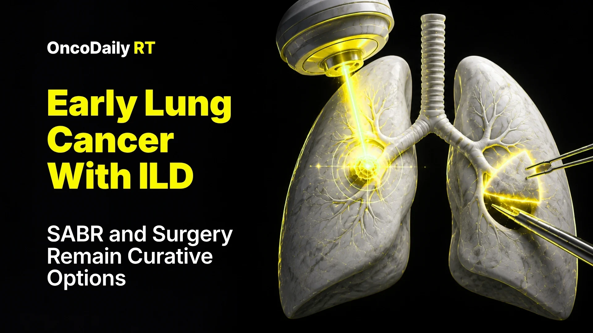 Early Lung Cancer With ILD: SABR and Surgery Remain Curative Options