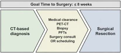 Jeffrey Velotta: Timely Surgery for Early Stage Lung Cancer is Important