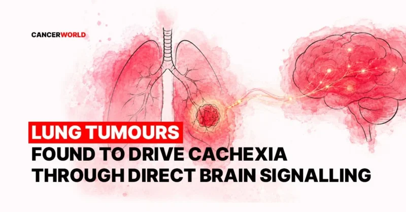 CancerWorld Explores a New Mechanism Behind Cancer Cachexia