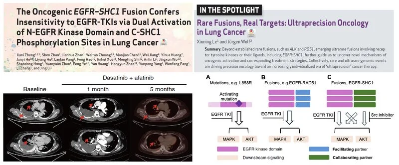 Xiuning Le: Novel EGFR–SHC1 Fusion Mechanism Driving Lung Cancer and Therapeutic Resistance