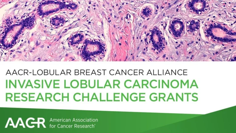 $50,000 Research Challenge Grants for Invasive Lobular Carcinoma – AACR