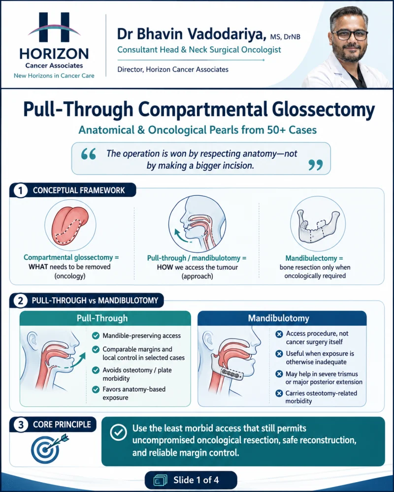 Lessons from 50+ Pull-Through Compartmental Glossectomies - Humans of Oncology 3 Lessons from 50+ Pull-Through Compartmental Glossectomies - Humans of Oncology