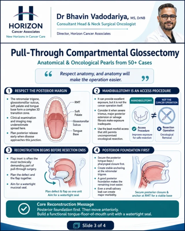 Lessons from 50+ Pull-Through Compartmental Glossectomies - Humans of Oncology 5 Lessons from 50+ Pull-Through Compartmental Glossectomies - Humans of Oncology