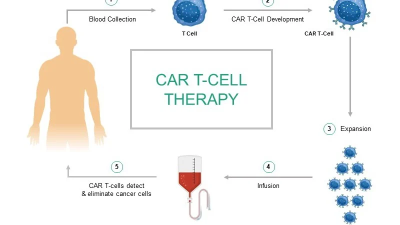 CAR-T