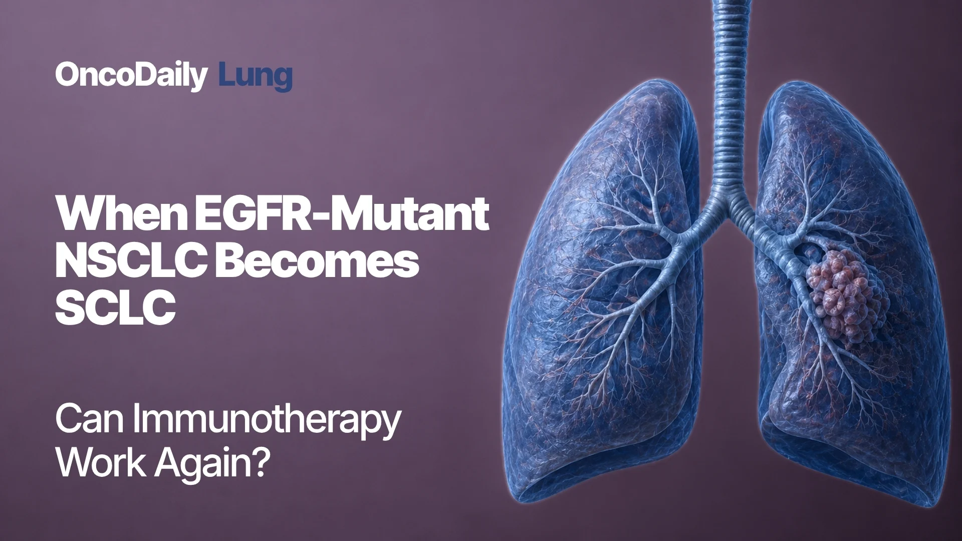 nsclc