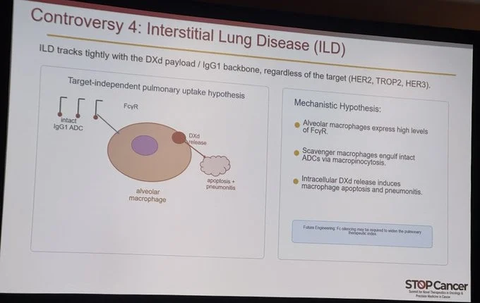 Antonio Giordano: Why Do DXd-ADCs Cause ILD Regardless of Target? 2 Antonio Giordano: Why Do DXd-ADCs Cause ILD Regardless of Target?