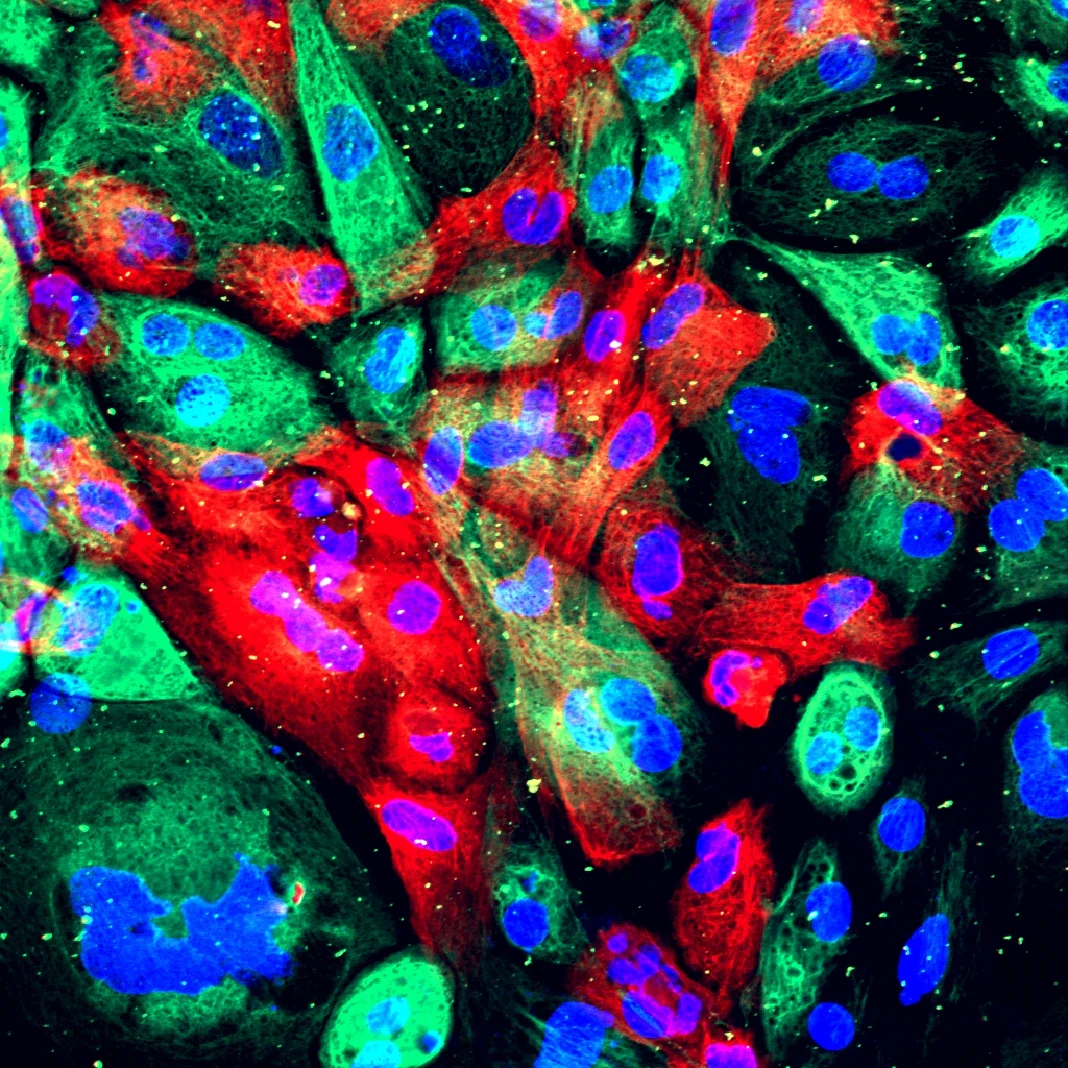 Anthony Letai: The Role of 3D Organoids in Revealing Drug Targets 2 Anthony Letai