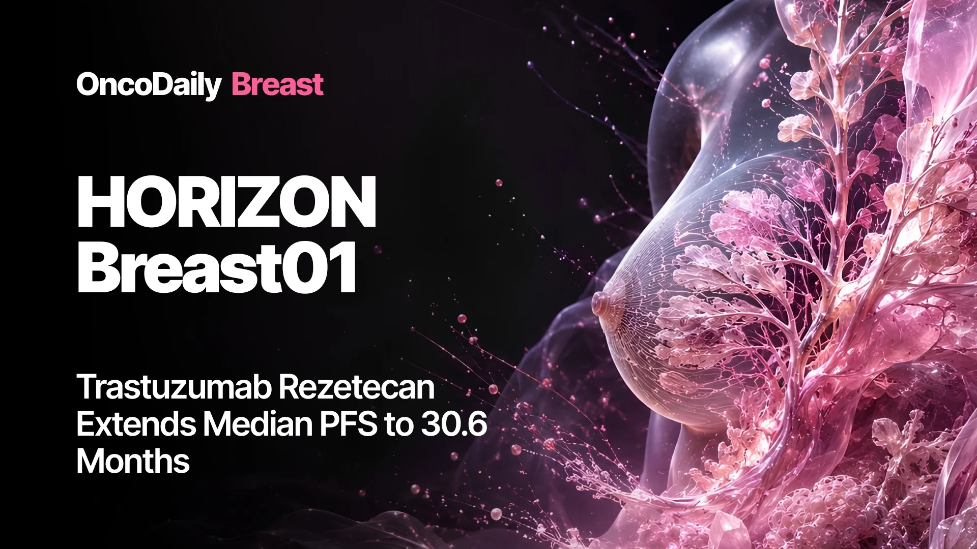 Trastuzumab Rezetecan