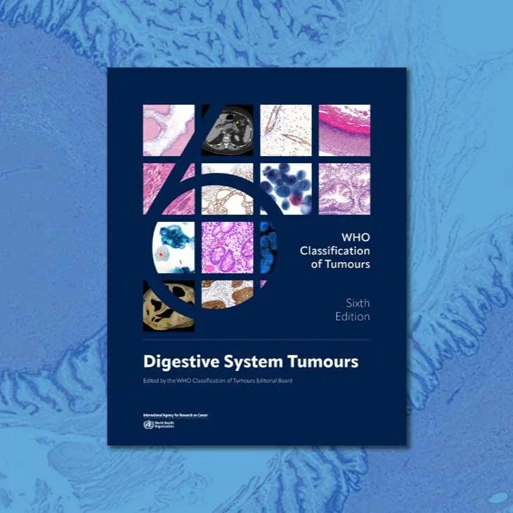 6th Edition of Digestive System Tumors Classification Is Now Available - IARC/WHO 2 International Agency for Research on Cancer (IARC) / World Health Organization