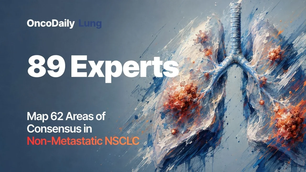 89 Experts Map Key Gray Zones in Non-Metastatic NSCLC