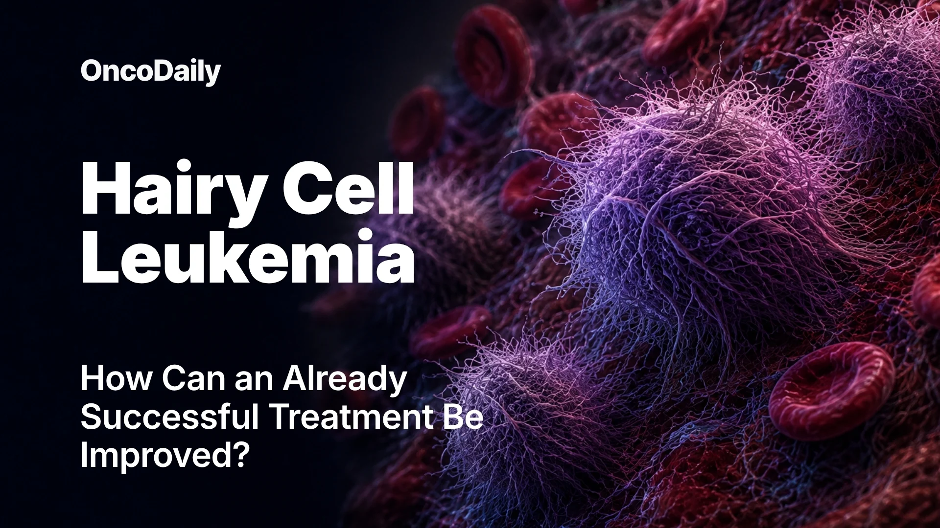 Hairy Cell Leukemia (HCL)
