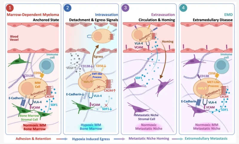 Extramedullary Disease in Multiple Myeloma (EMD): Progress in the Immunotherapy Era 2 Extramedullary Disease in Multiple Myeloma (EMD): Progress in the Immunotherapy Era