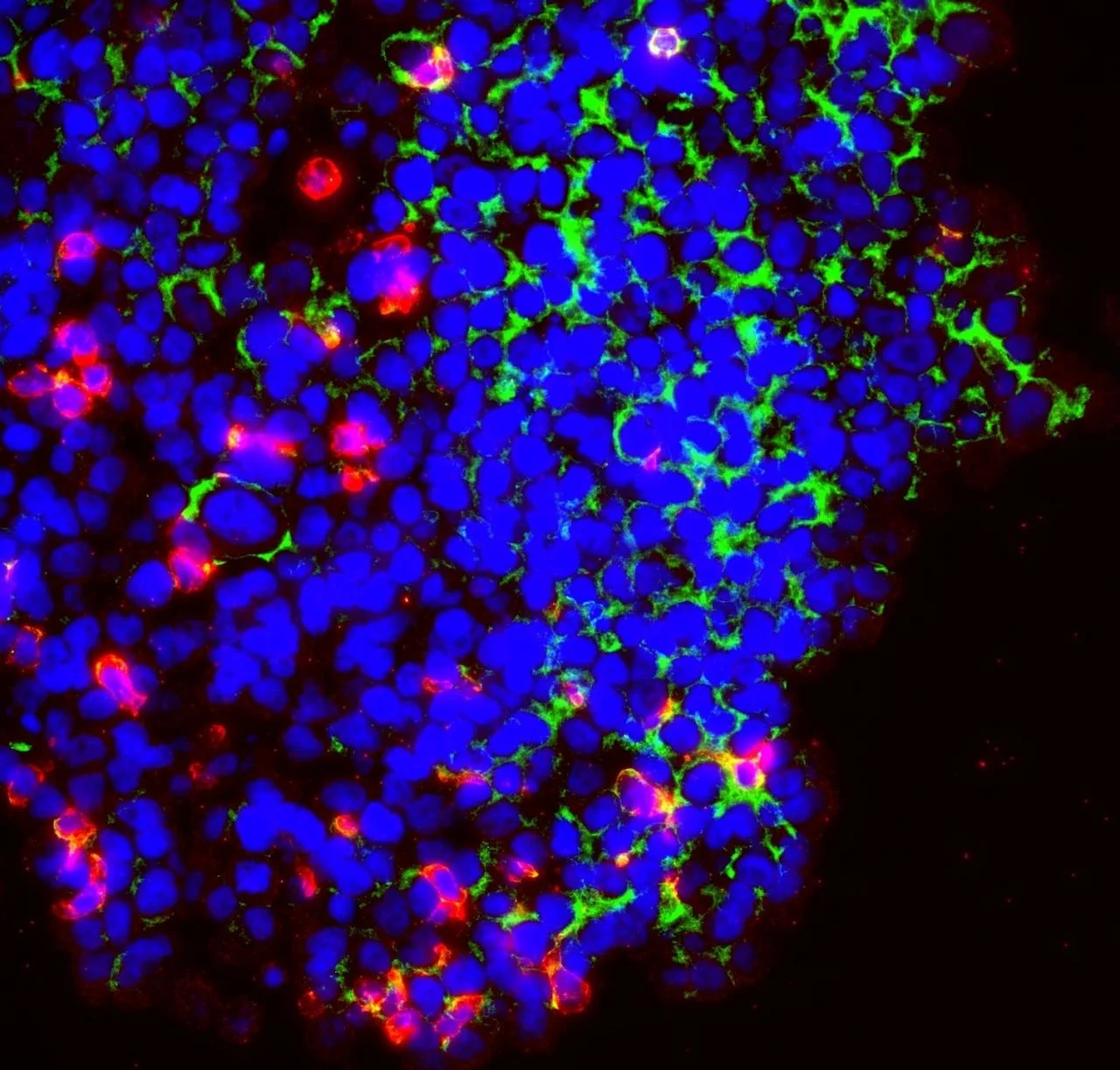 Mel Mann: Engineering Immune Cells to Follow Cancer’s Metabolic "Scent" 2 Mel Mann