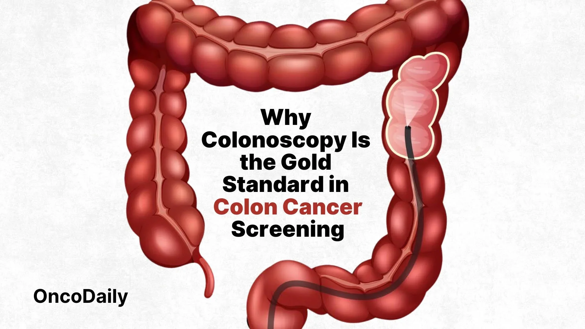 John Andretti's Legacy Inspires a Powerful Colon Cancer Screening Mission - CheckIt4Andretti 2 CheckIt4Andretti
