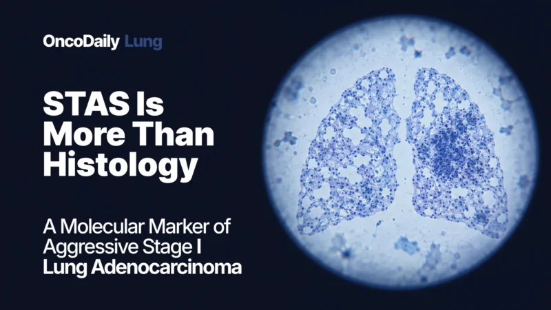 STAS in Stage I Lung Adenocarcinoma Is More Than a Histologic Finding: Multi-Omic Profiling Reveals an Aggressive Molecular Phenotype