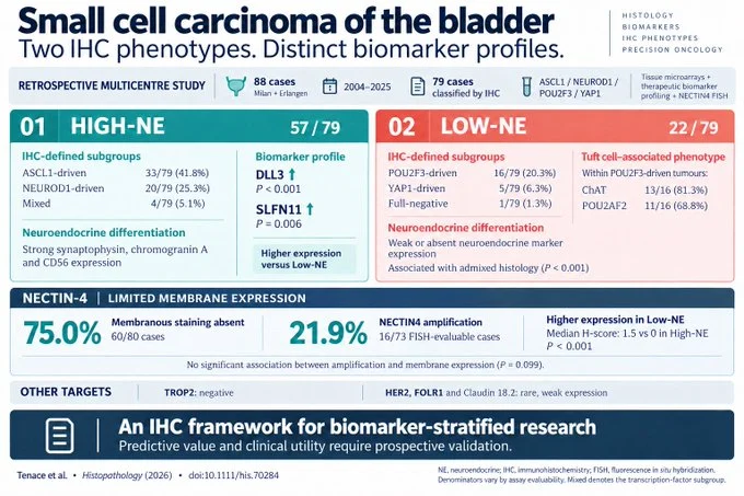 Sabine D. Brookman-May: Rethinking Targeted Therapy in Small Cell Bladder Cancer 2 Sabine D. Brookman-May: Rethinking Targeted Therapy in Small Cell Bladder Cancer