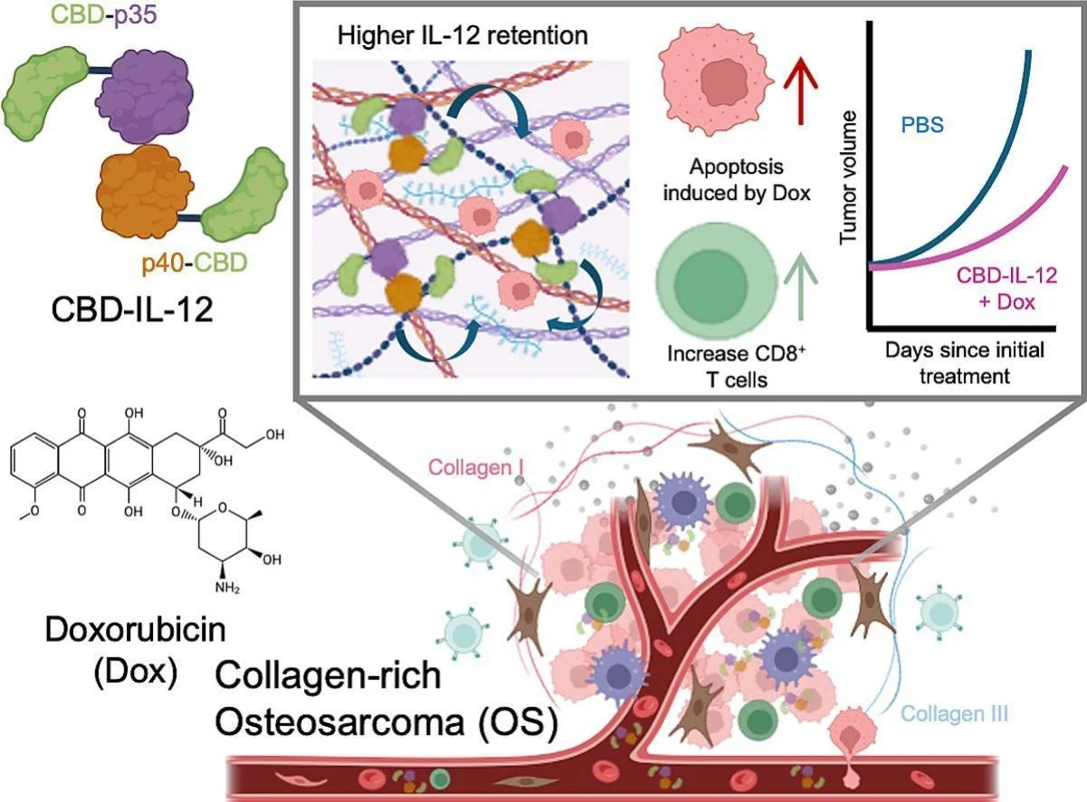 Osteosarcoma