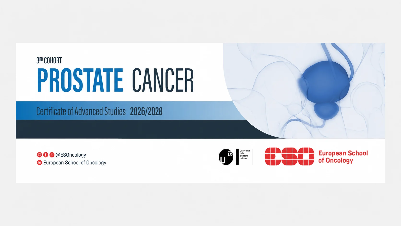 Prostate Cancer