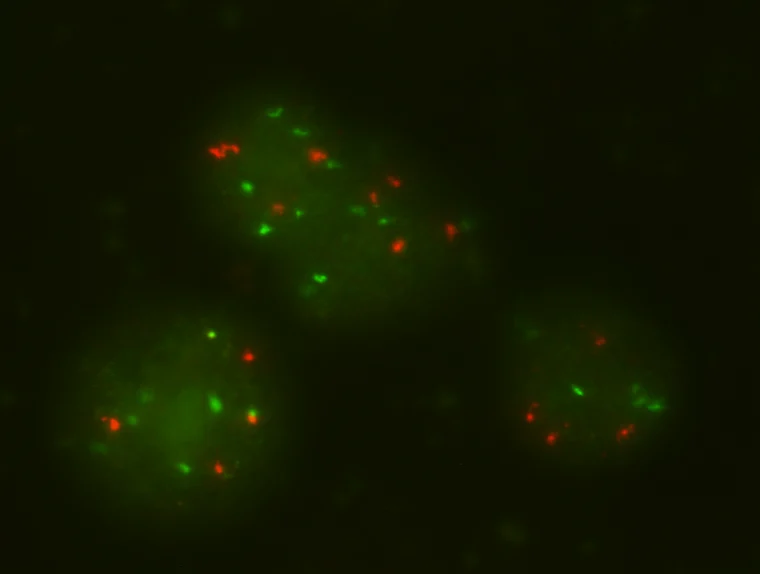 Rare Cells, Big Stories: What Circulating Tumor Cells Can Tell Us About Cancer 3 tethis