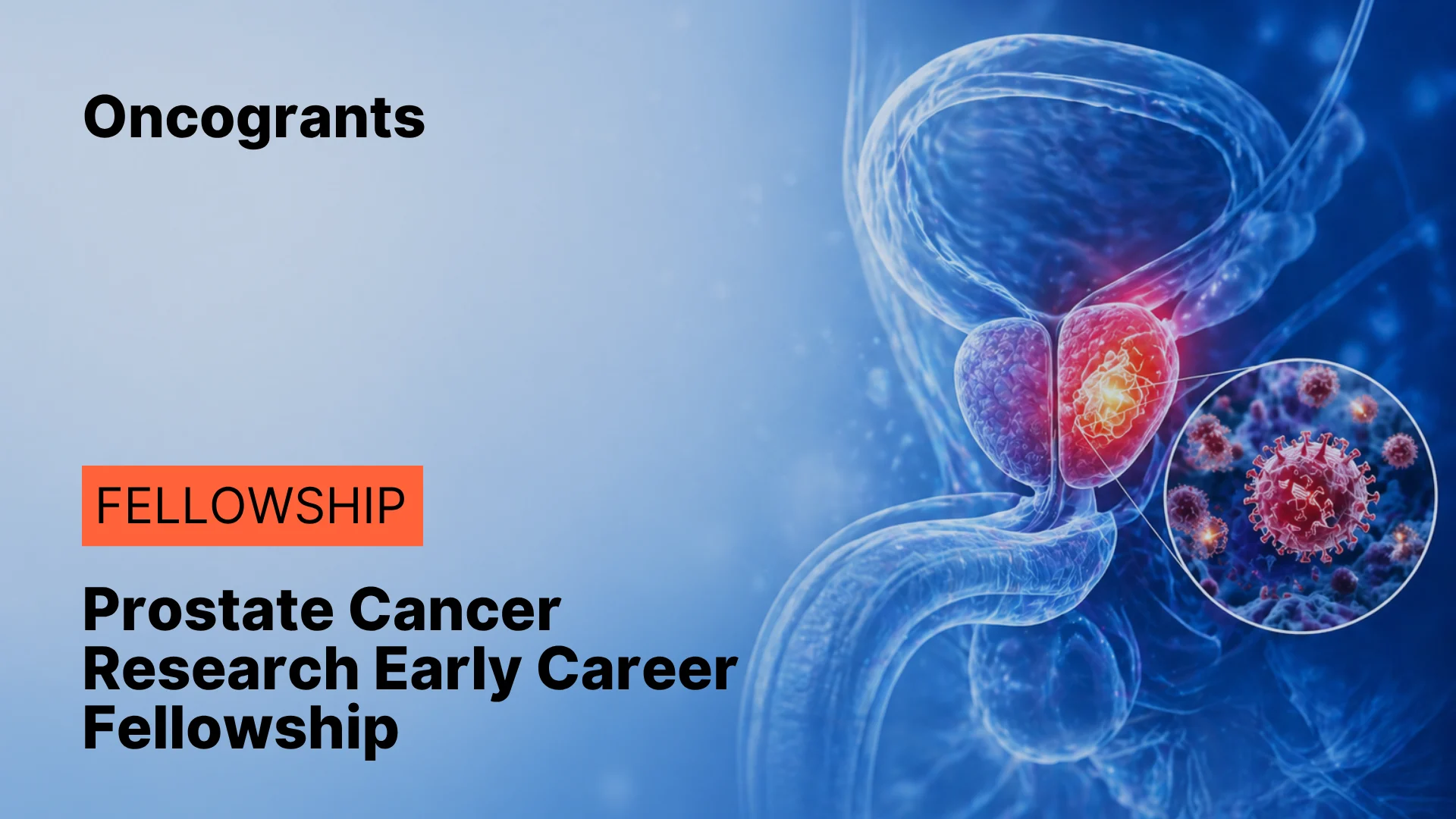 Prostate Cancer Research