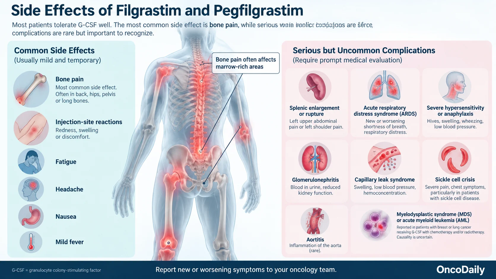 Filgrastim and Pegfilgrastim After Chemotherapy: Why Cancer Patients Need Growth Factor Injections