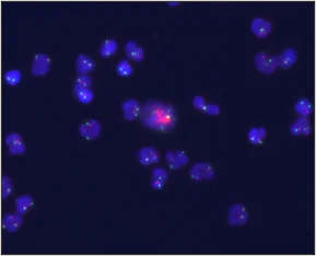 Rare Cells, Big Stories: What Circulating Tumor Cells Can Tell Us About Cancer 3 Tethis