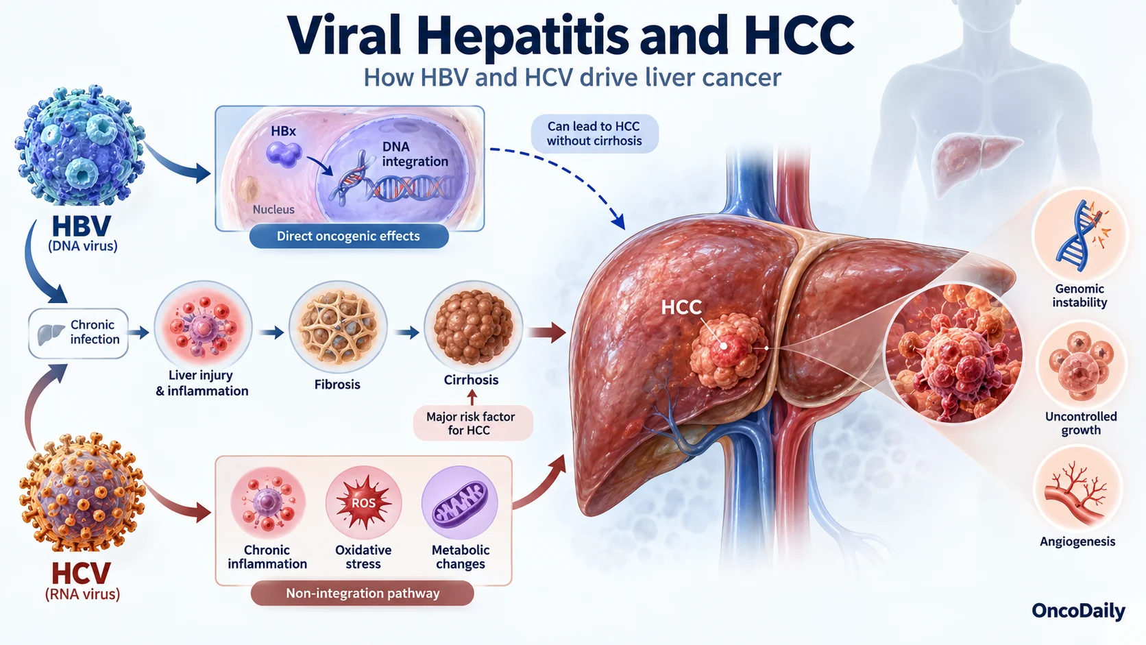 Hepatocellular Carcinoma and Viral Hepatitis: How HBV and HCV Drive Liver Cancer