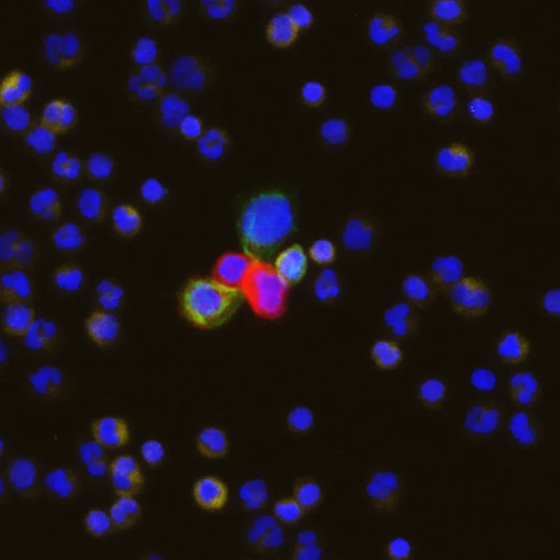 Rare Cells, Big Stories: What Circulating Tumor Cells Can Tell Us About Cancer 4 Tethis