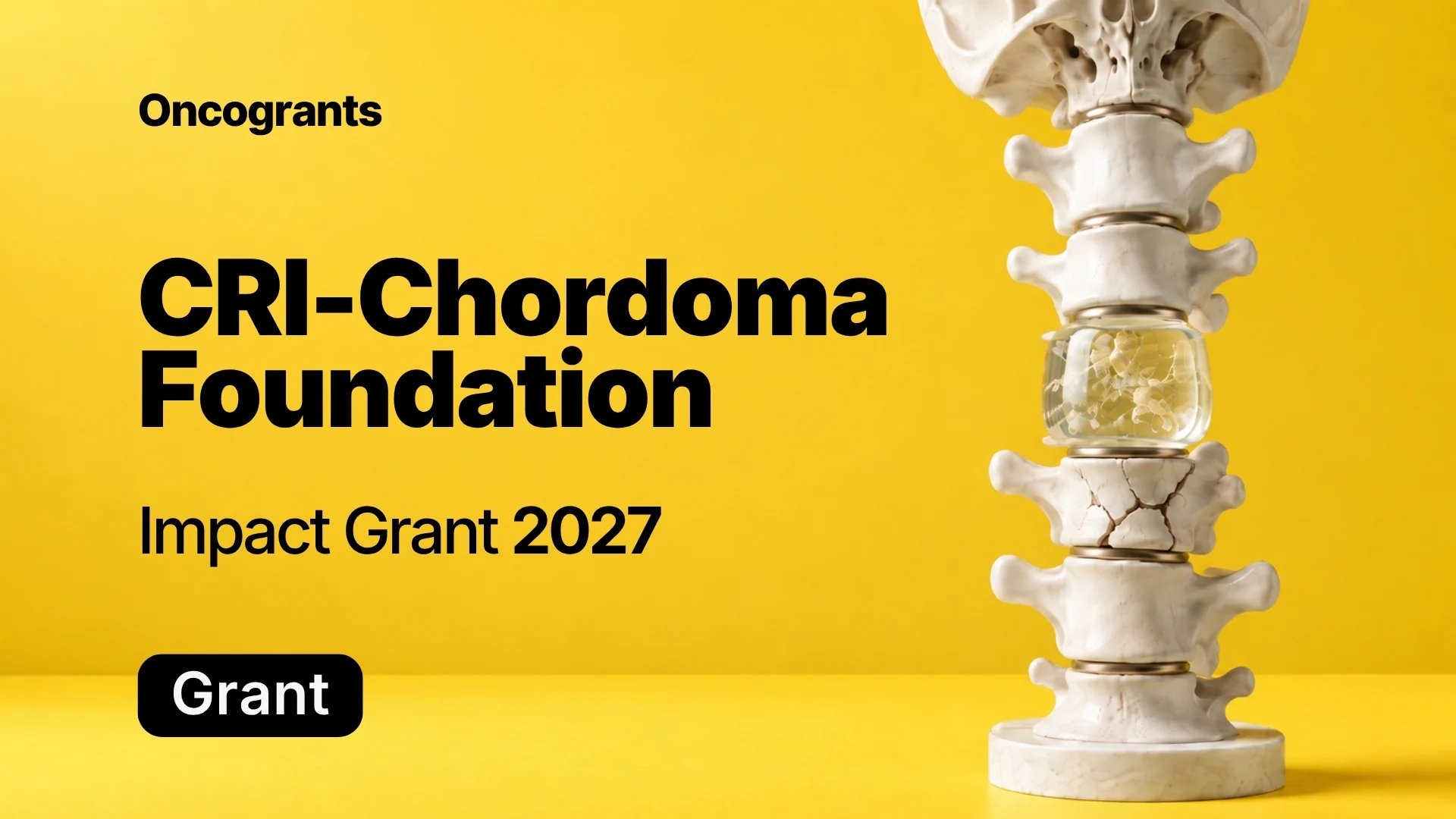 Chordoma Foundation