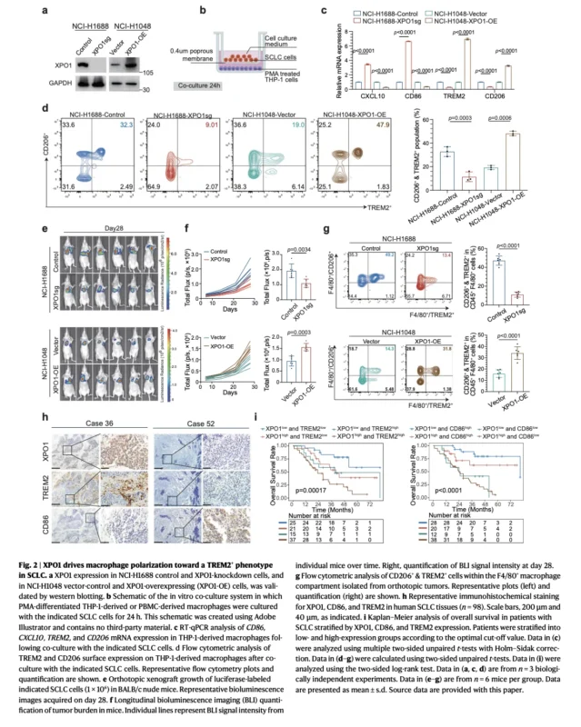 XPO1 Inhibition May Reprogram Immune Resistance in SCLC: The TRIM21–IRF3–TNFSF15–TREM2 Axis 3 XPO1