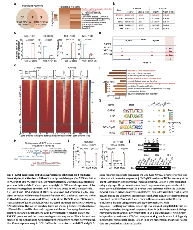 XPO1 Inhibition May Reprogram Immune Resistance in SCLC: The TRIM21–IRF3–TNFSF15–TREM2 Axis 4 XPO1
