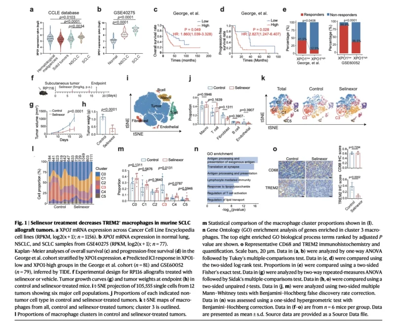 XPO1 Inhibition May Reprogram Immune Resistance in SCLC: The TRIM21–IRF3–TNFSF15–TREM2 Axis 2 XPO1
