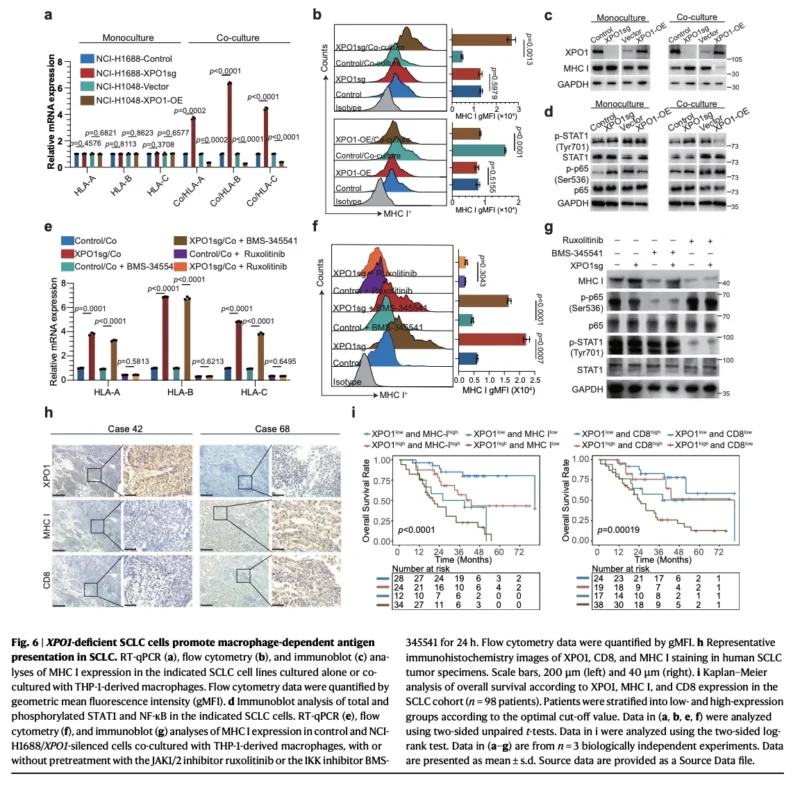 XPO1 Inhibition May Reprogram Immune Resistance in SCLC: The TRIM21–IRF3–TNFSF15–TREM2 Axis 7 XPO1