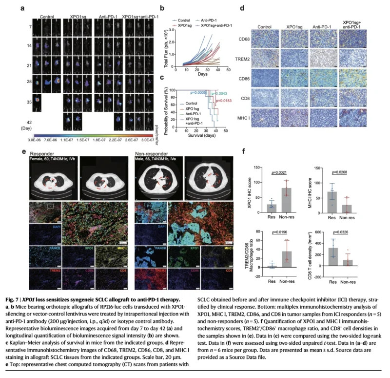 XPO1 Inhibition May Reprogram Immune Resistance in SCLC: The TRIM21–IRF3–TNFSF15–TREM2 Axis 8 XPO1