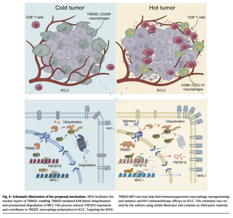 XPO1 Inhibition May Reprogram Immune Resistance in SCLC: The TRIM21–IRF3–TNFSF15–TREM2 Axis 9 XPO1