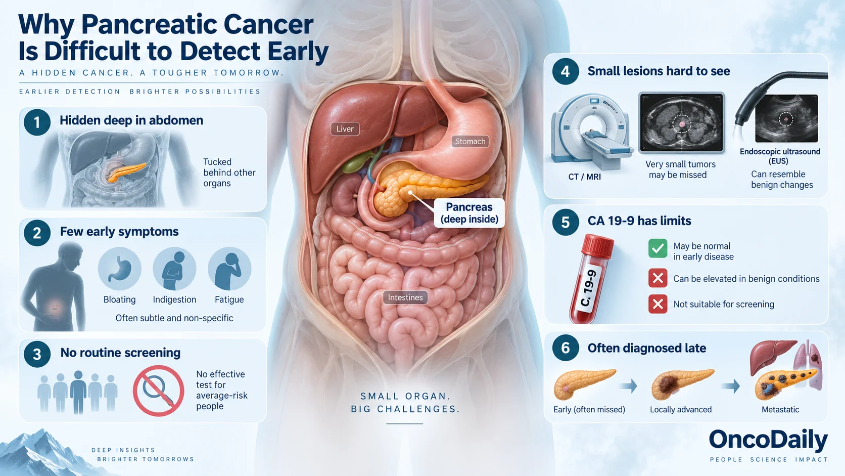Can Pancreatic Cancer Be Detected Early? Symptoms, Biomarkers, and New Tests