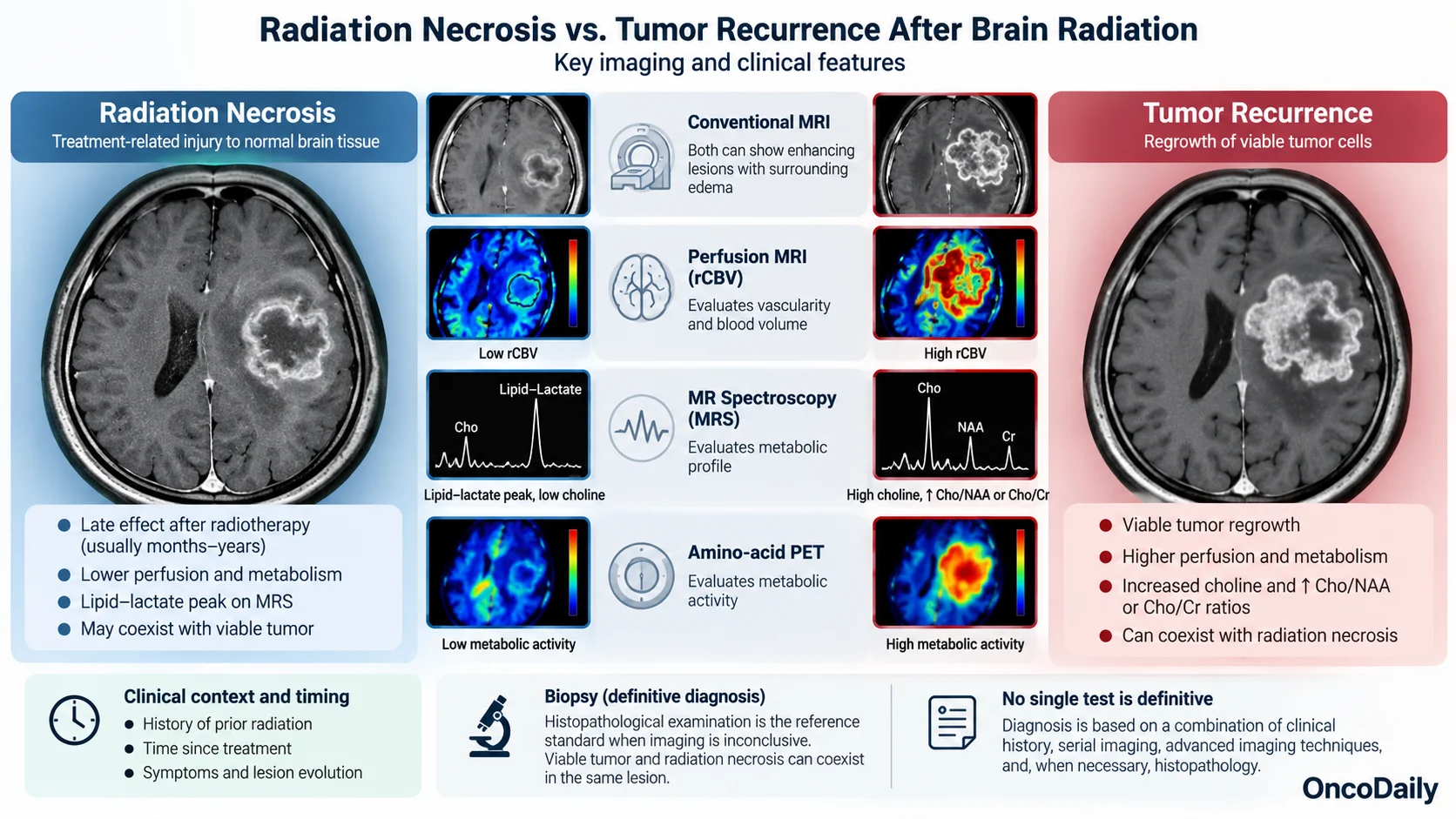 Radiation Necrosis After Brain Radiation: Symptoms, Diagnosis, Treatment, and Recovery
