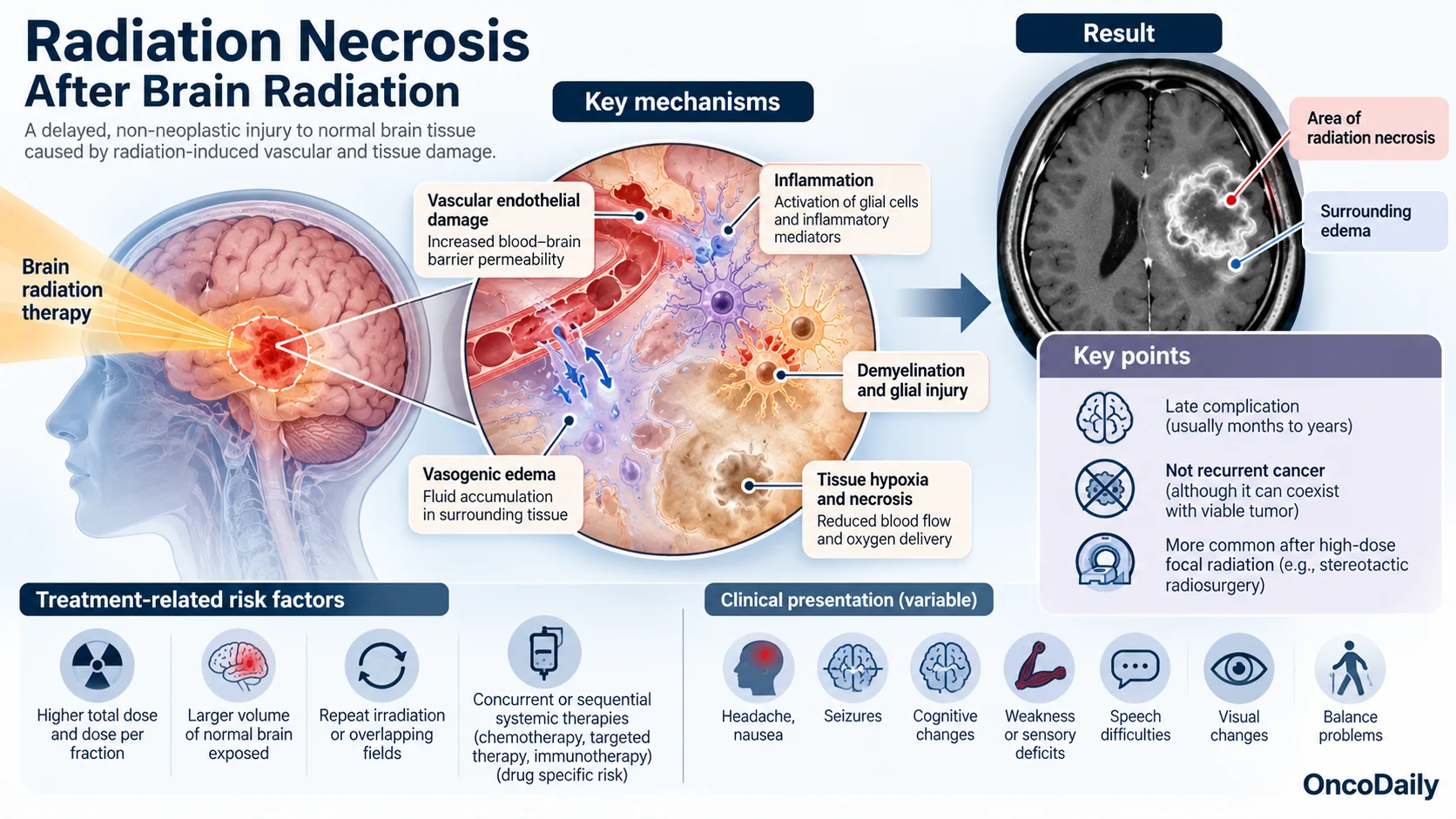Radiation Necrosis After Brain Radiation: Symptoms, Diagnosis, Treatment, and Recovery