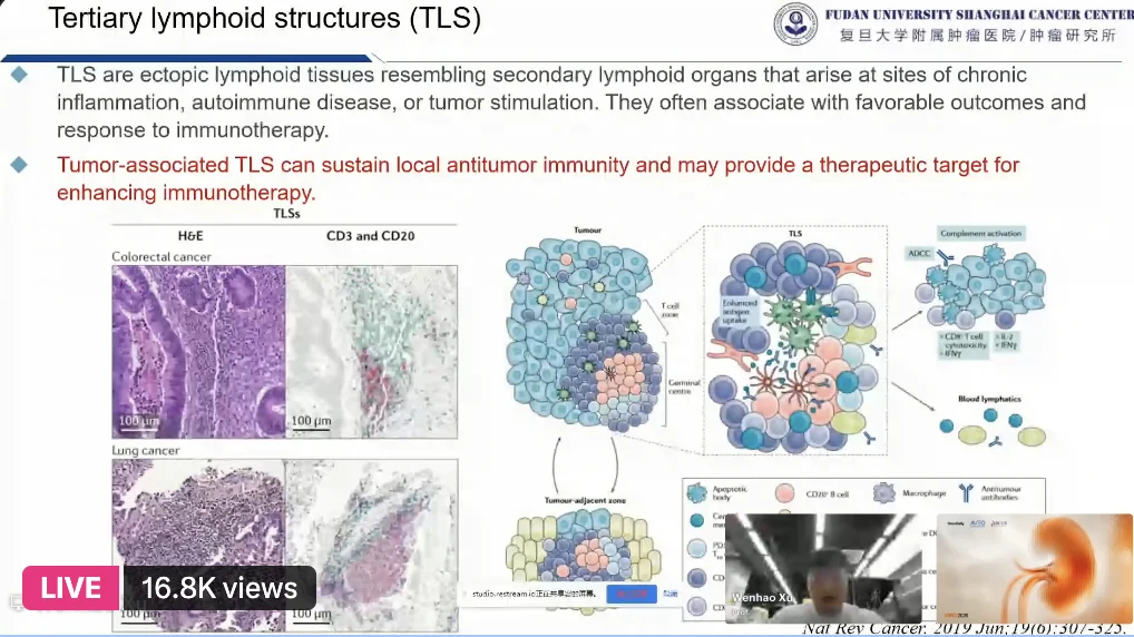 Highlights From VIRO 2026 – Global Voices in Renal Oncology, Day 1 6 Highlights From VIRO 2026 – Global Voices in Renal Oncology, Day 1