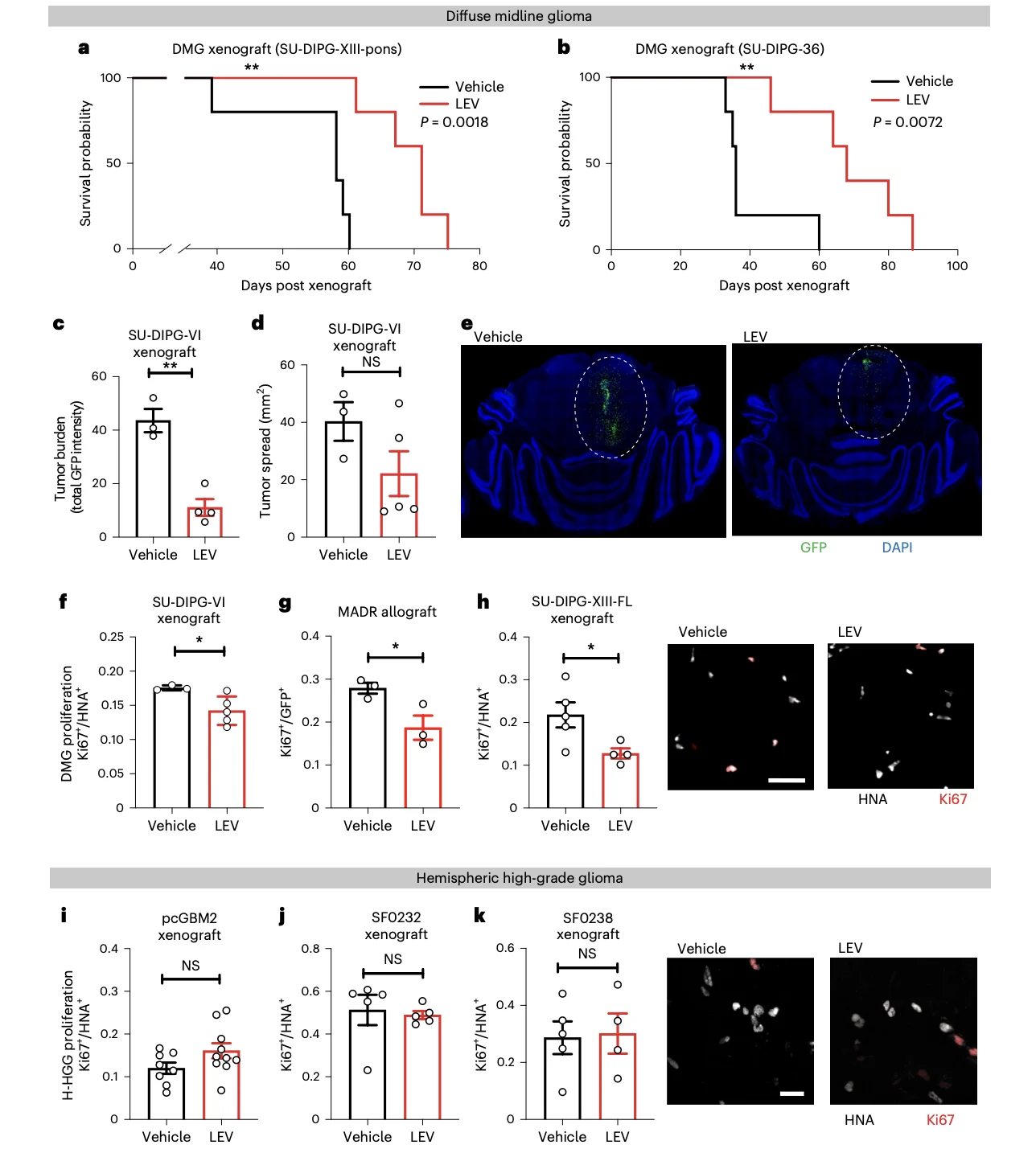 New Paper Alert: Antiseizure Drug Levetiracetam Linked to Longer Survival in Diffuse Midline Glioma