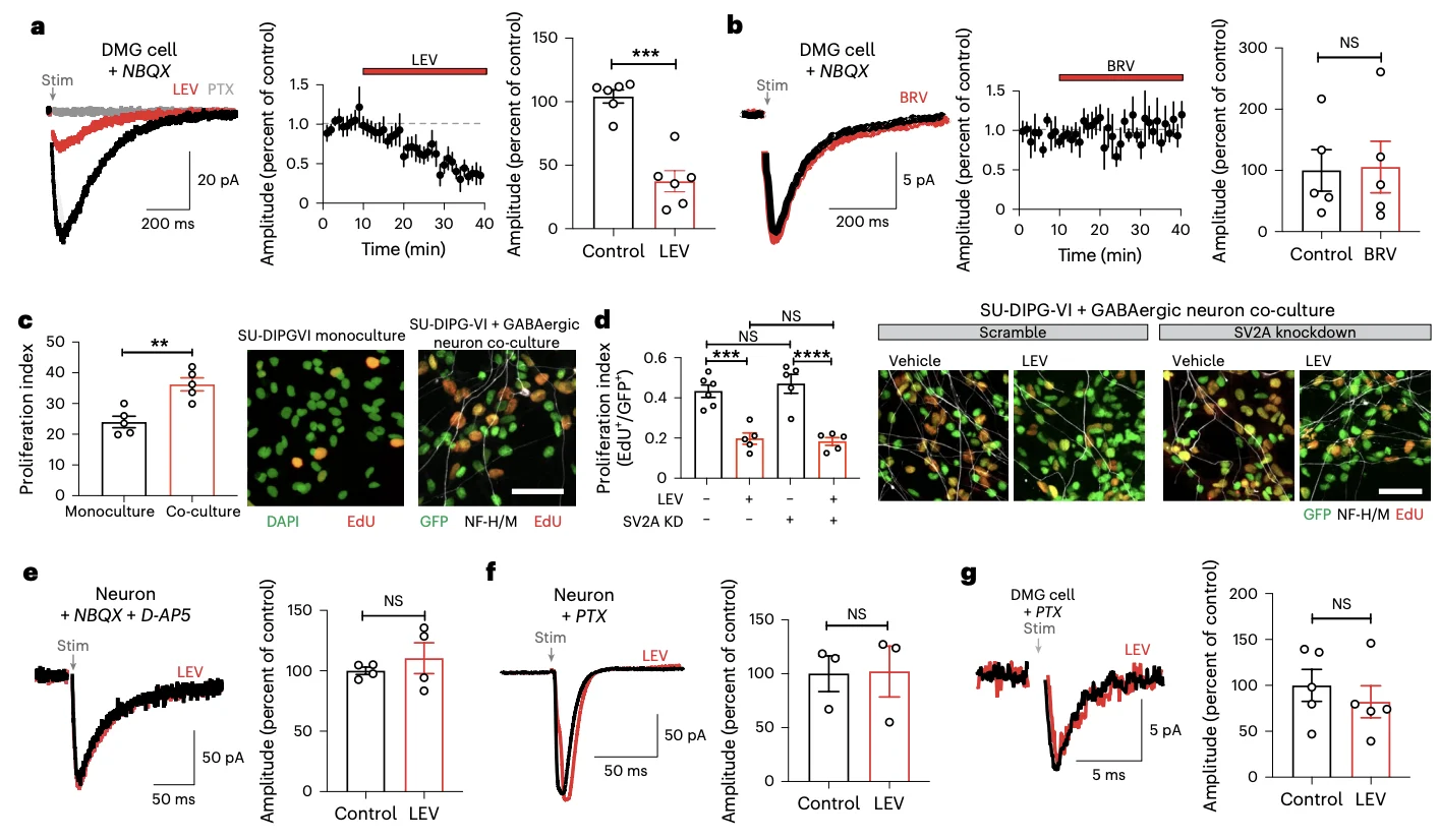 New Paper Alert: Antiseizure Drug Levetiracetam Linked to Longer Survival in Diffuse Midline Glioma