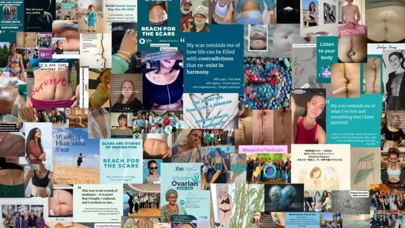 Shabnam Gujadhur and Christel Paganoni-Bruijns on Listening to Women With Ovarian Cancer 2 Shabnam Gujadhur and Christel Paganoni-Bruijns