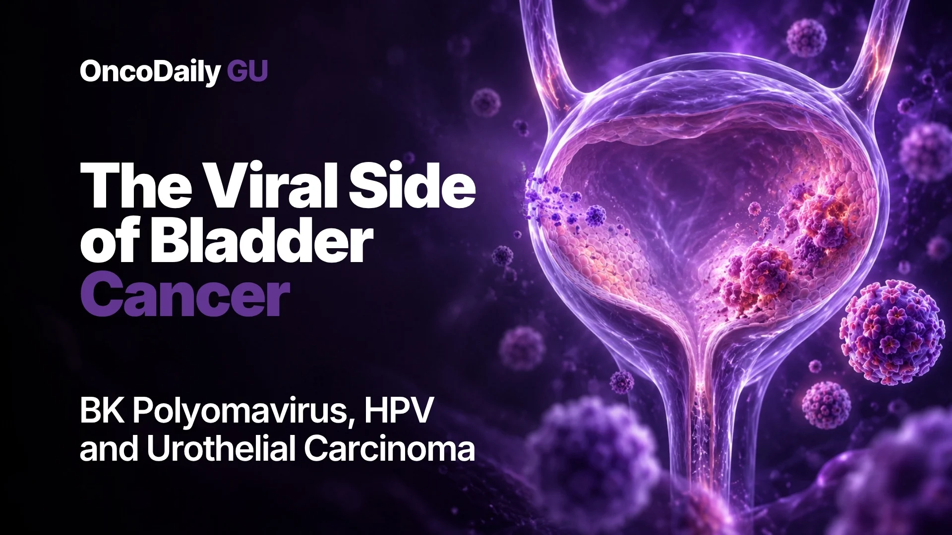 The Viral Side of Bladder Cancer: BK Polyomavirus, HPV, and Urothelial Carcinoma