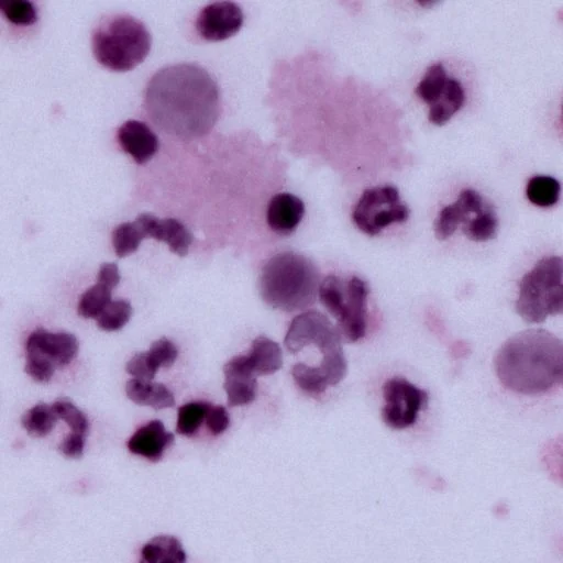 Rare Cells, Big Stories: What Circulating Tumor Cells Can Tell Us About Cancer 2 tethis