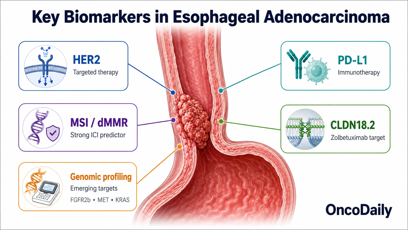 Esophageal Adenocarcinoma Biomarkers: HER2, PD-L1, MSI, CLDN18.2 and Emerging Targets