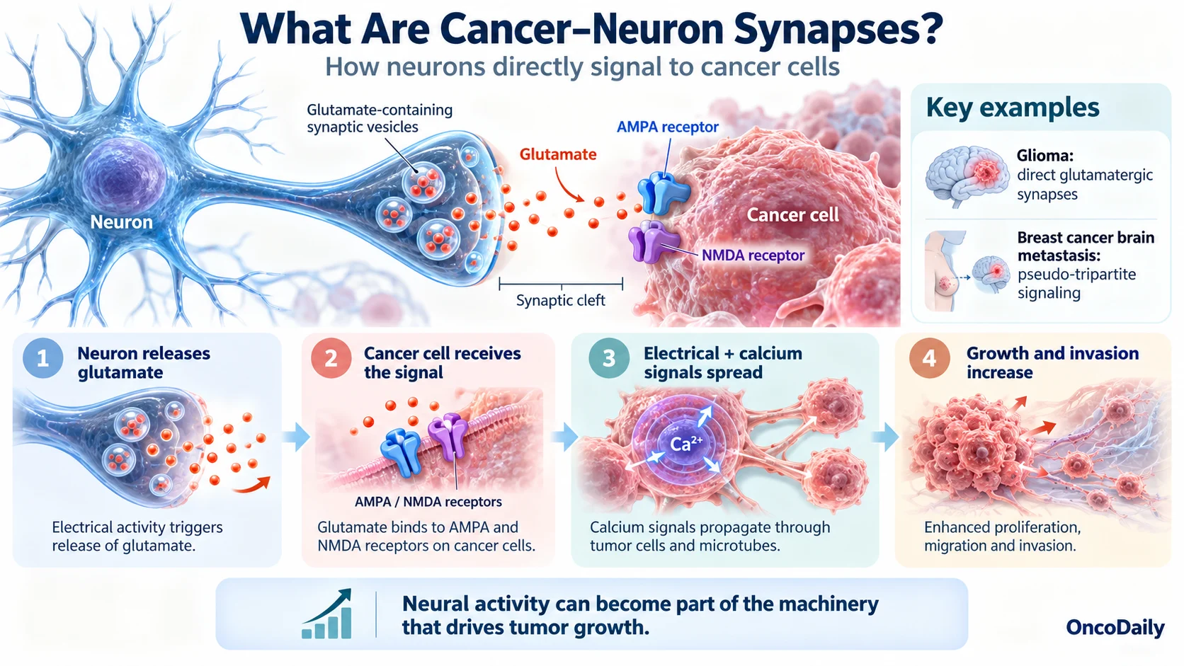Cancer and the Brain: How Tumors Hijack Neural Signals to Fuel Tumor Growth