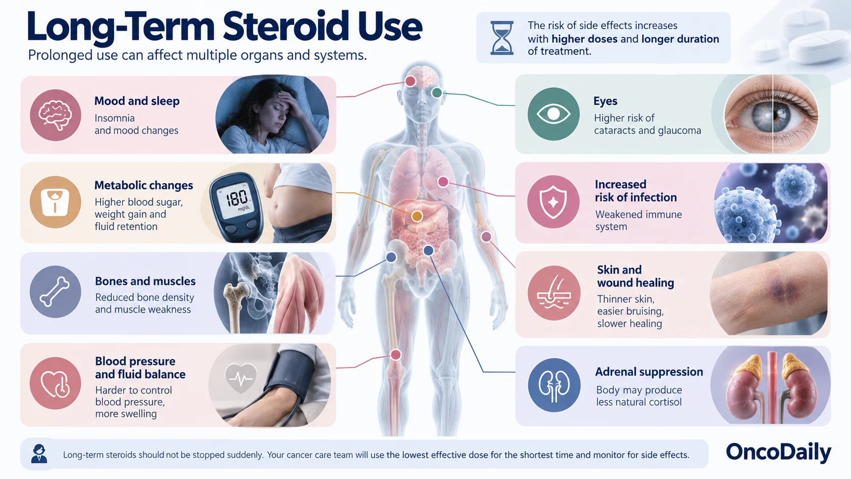 Why Are Steroids Used During Cancer Treatment? Benefits, Side Effects, and What Patients Should Know 6 Why Are Steroids Used During Cancer Treatment? Benefits, Side Effects, and What Patients Should Know